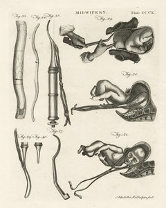 Midwifery (illustration from 